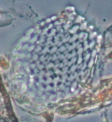 Euglypha