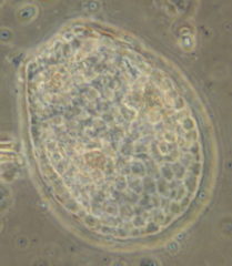 Euglypha