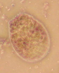 Euglypha