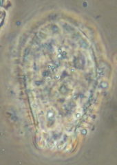 Euglypha strigosa