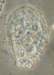 Euglypha strigosa