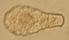 Hyalosphenia