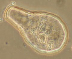 Hyalosphenia