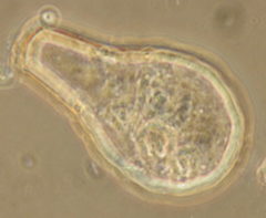 Hyalosphenia