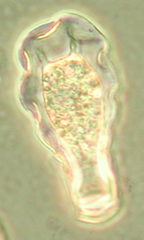 Hyalosphenia