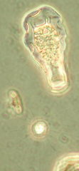 Hyalosphenia