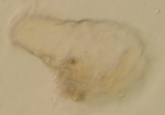 Hyalosphenia