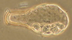 Hyalosphenia