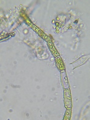 Rhizoclonium
