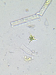 Staurodesmus cuspidatus