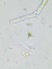 Staurodesmus cuspidatus