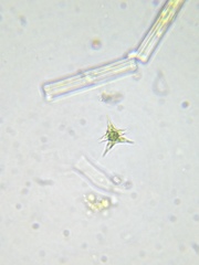 Staurodesmus cuspidatus