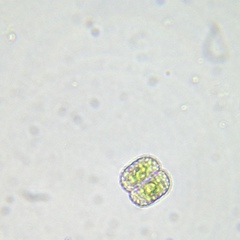 Cosmarium anisochondrum