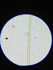 Closterium acutum