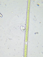 Closterium acutum