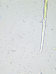 Closterium acutum