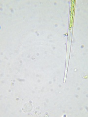 Closterium acutum