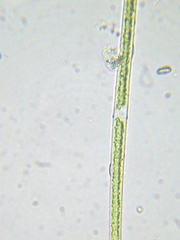 Closterium acutum