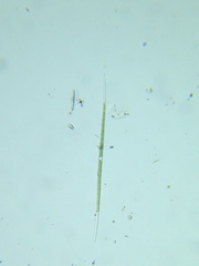 Closterium acutum