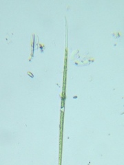 Closterium acutum