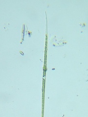 Closterium acutum
