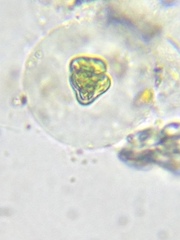 Staurastrum punctulatum