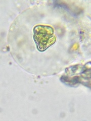 Staurastrum punctulatum