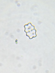 Staurastrum punctulatum