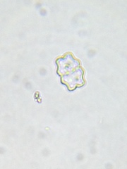 Staurastrum punctulatum