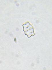 Staurastrum punctulatum