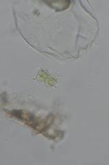 Staurastrum furcatum