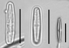 Achnanthidium minutissimum