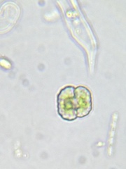 Cosmarium anisochondrum