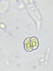 Cosmarium anisochondrum