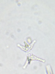 Staurastrum ankyroides