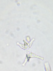 Staurastrum ankyroides