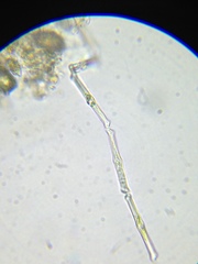 Entosiphon
