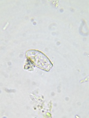 Euglypha