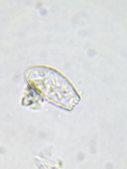 Euglypha