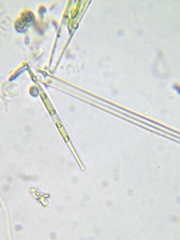 Closterium limneticum