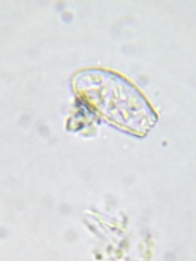 Euglypha acanthophora