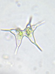 Staurodesmus cuspidatus