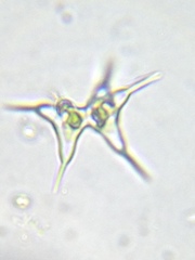 Staurodesmus cuspidatus