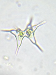 Staurodesmus cuspidatus