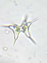 Staurodesmus cuspidatus