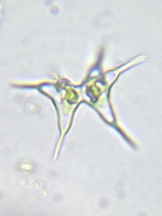 Staurodesmus cuspidatus