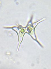 Staurodesmus cuspidatus