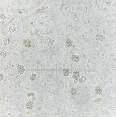 Inocybe margaritispora