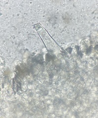 Inocybe margaritispora