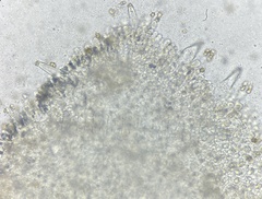 Inocybe margaritispora